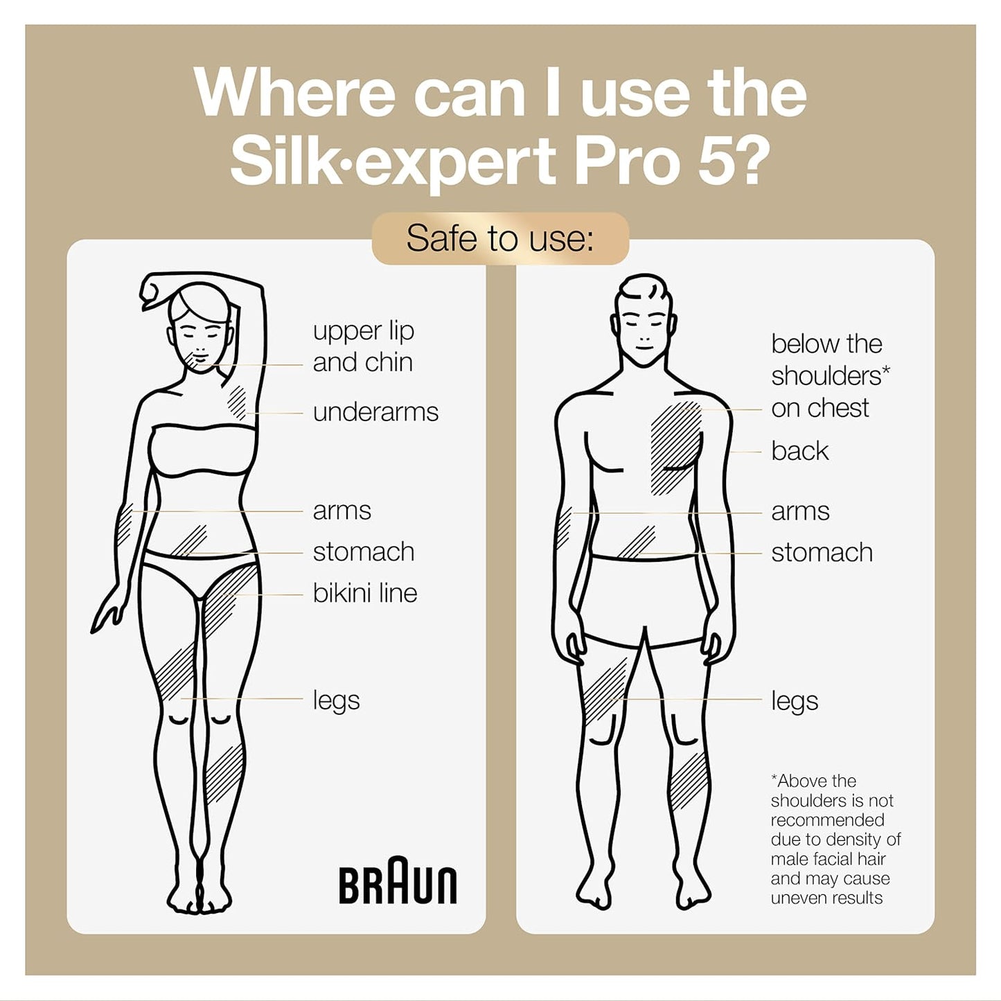 Braun IPL Hair Removal for Women and Men, New Silk Expert Pro 5 PL5157 FDA Cleared, for Body & Face, At-Home Permanent Hair Reduction, Alternative to Salon Laser Hair Removal, with Venus Razor, Pouch